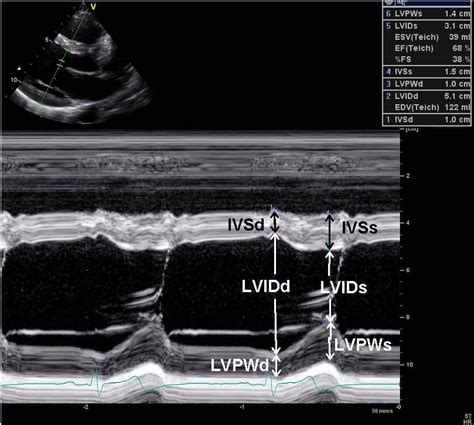 lvrwt echo.